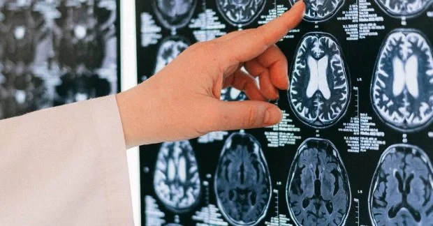 Мозок не стирає всі спогади: дослідники виявили «мовчазну» пам’ять